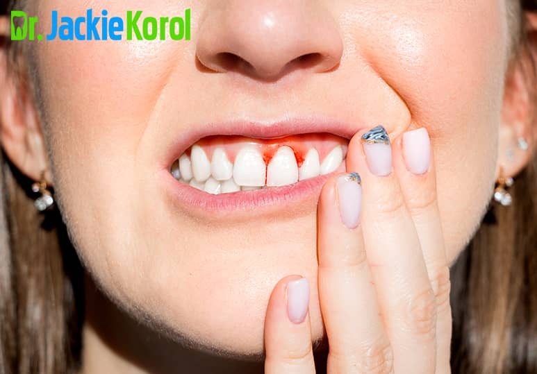 Dr Jackie Korol - Blog -  Gum Disease Awareness Month